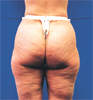 fat_butt